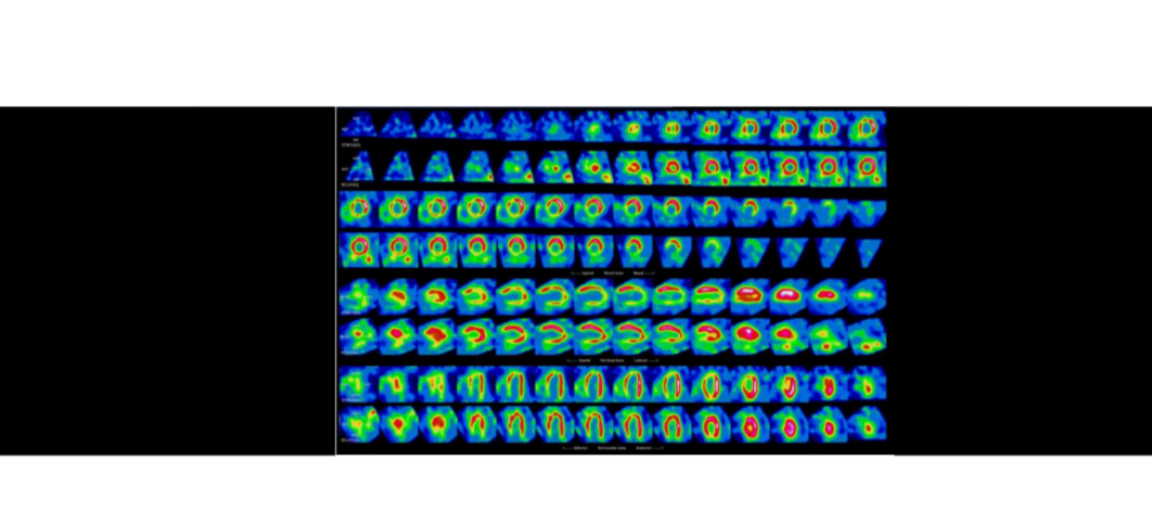 Visuel en cours de préparation