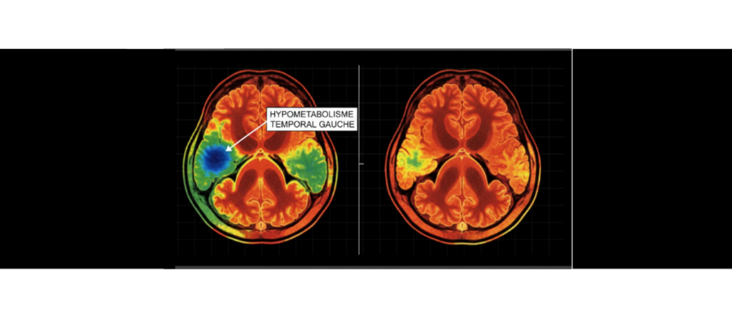 Visuel en cours de préparation