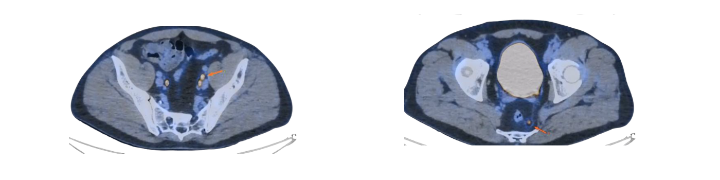 Visuel en cours de préparation